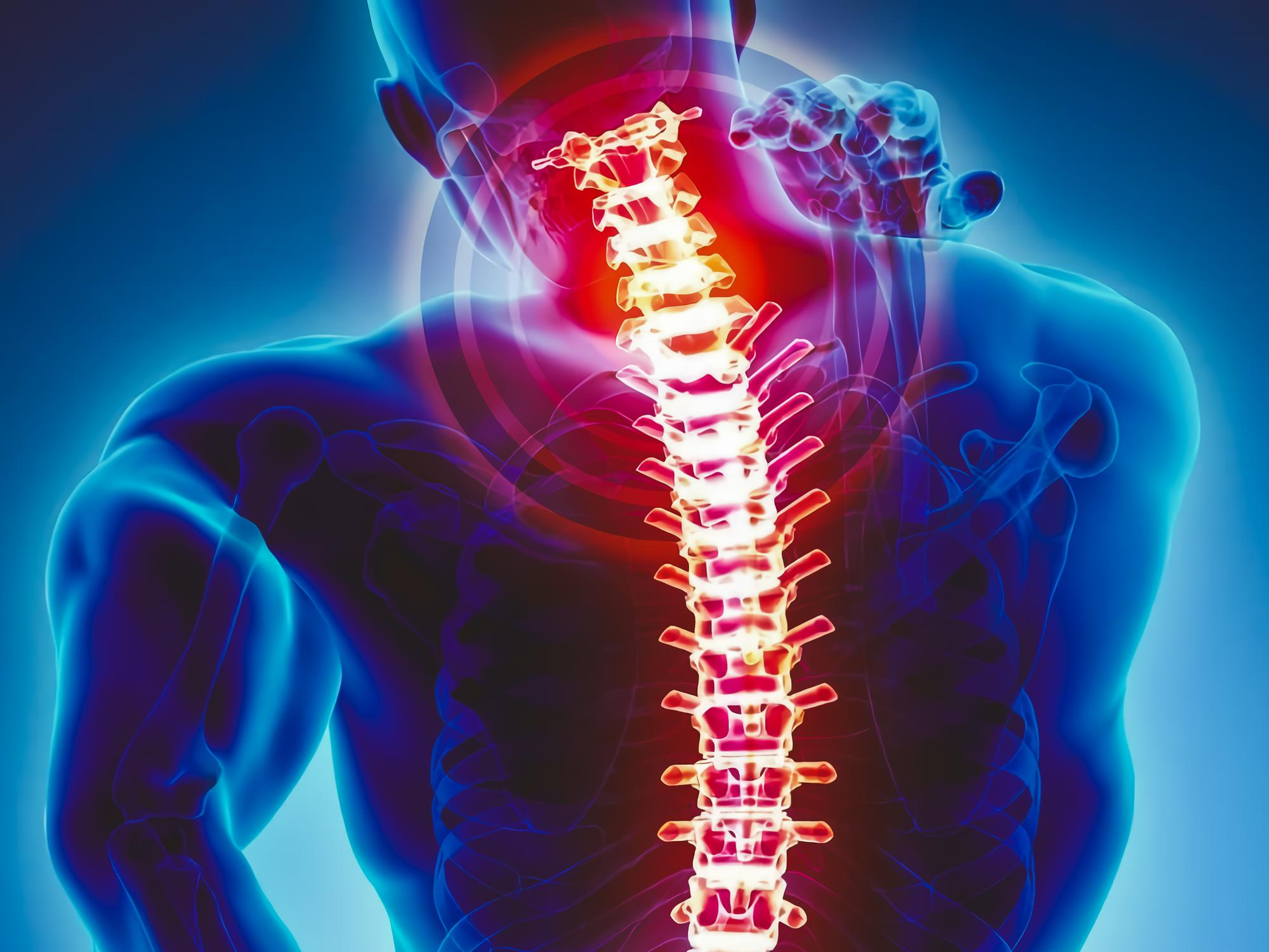 illustration of male spine and neck pain